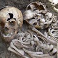Squelette d'un enfant de 5 ans victime de la famine