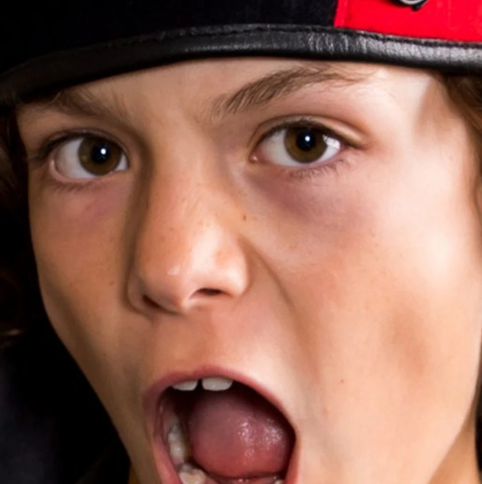 Young person with curly hair wearing a black beret and grey t-shirt shouting with mouth open in an indoor setting.