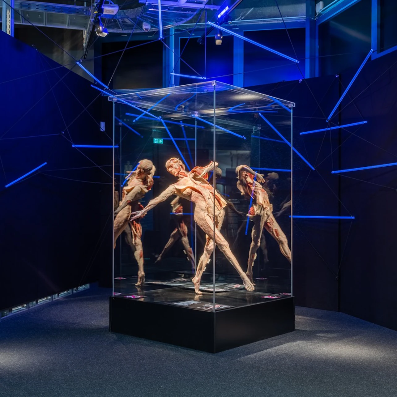 BODY WORLDS Berlin - The First Museum of BODY WORLDS in Berlin β Tiqets
