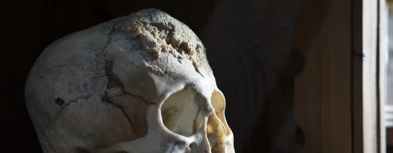 Sick To Death: Biglietto d'ingresso