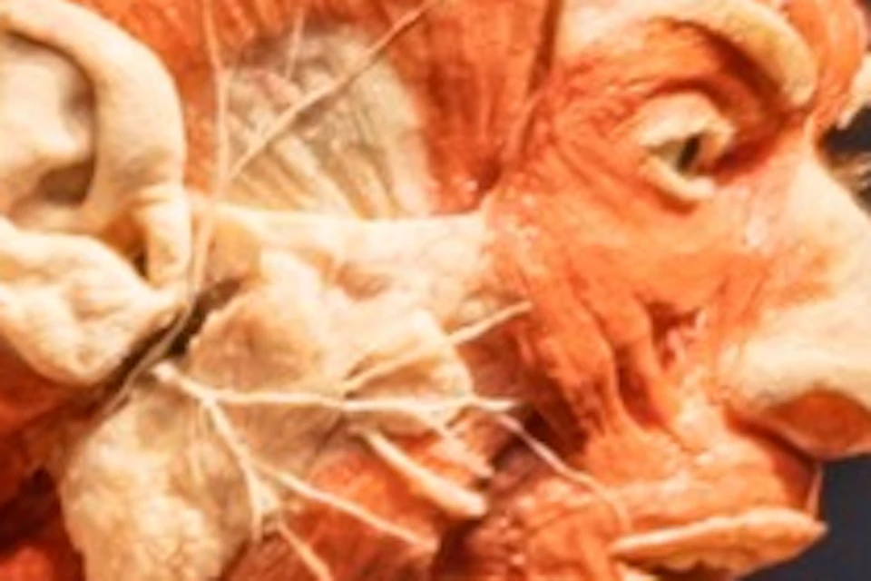 Plastinat "Sprinter"
